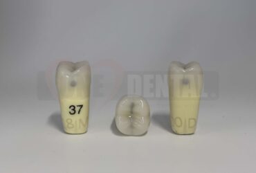 Caries Tooth 37 MO + DO for ADC Model(دندان پوسیده 37M+O + D برای مدل ADC)