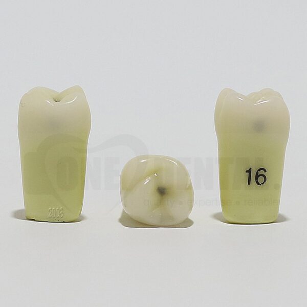 Caries Tooth 16M+O+D for 2008 Adult Model(دندان پوسیده 16M+O+D برای مدل بزرگسال 2008)