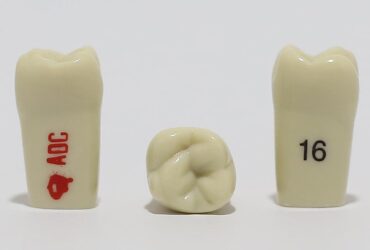 ADC Tooth 16 for ADC Model(مدل دندان 16 برای مدل ADC)