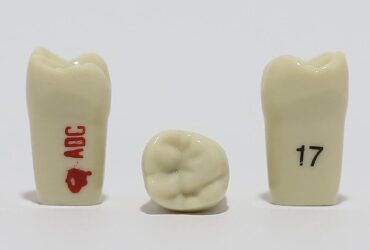 ADC Tooth 17 for ADC Model(مدل دندان 17 برای مدل ADC)