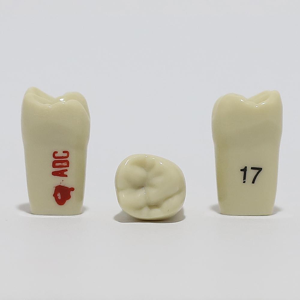 ADC Tooth 17 for ADC Model(مدل دندان 17 برای مدل ADC)