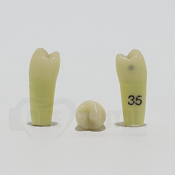 Caries Tooth 35M+O for ADC Model(دندان پوسیده 35M+O برای مدل ADC)