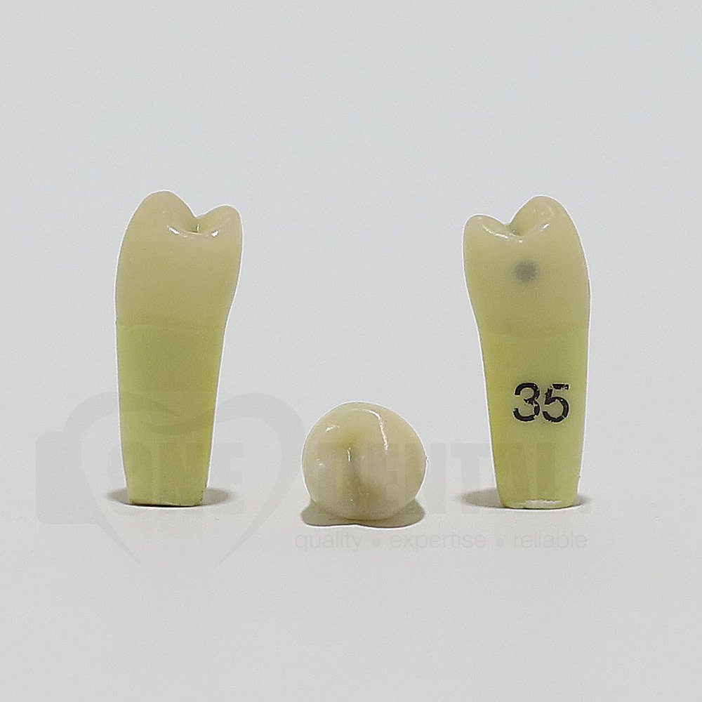 Caries Tooth 35M+O for ADC Model(دندان پوسیده 35M+O برای مدل ADC)