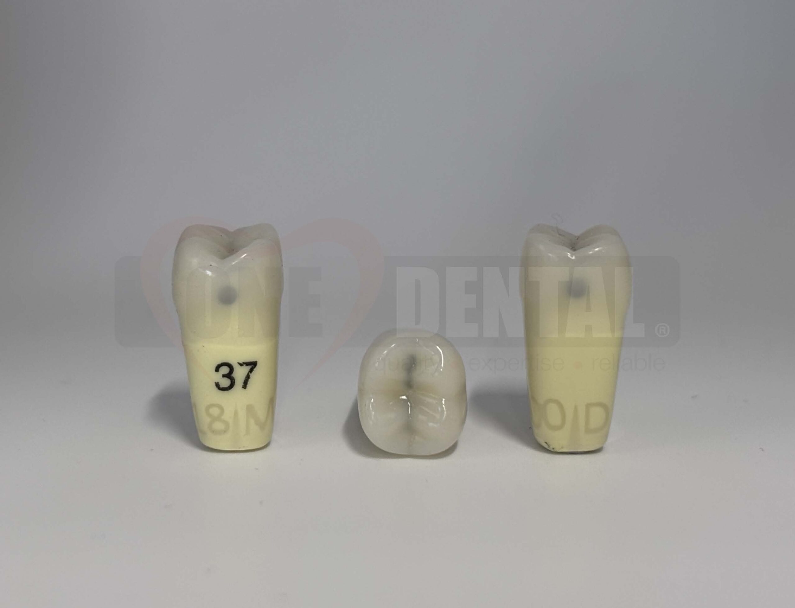 Caries Tooth 37 MO + DO for ADC Model(دندان پوسیده 37M+O + D برای مدل ADC)