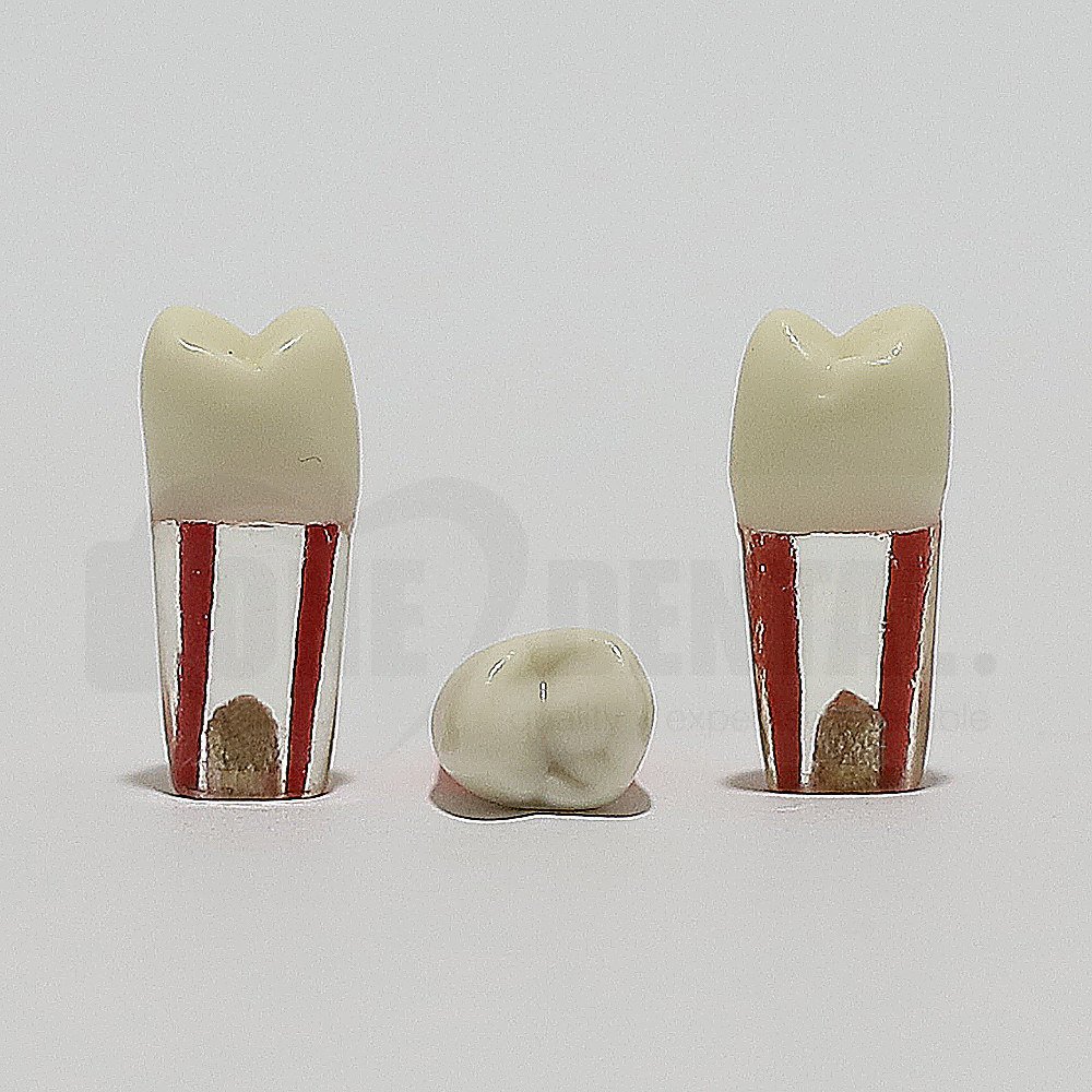 Endo Tooth 14 for ADC Model(مدل دندان Endo 14 برای مدل ADC)