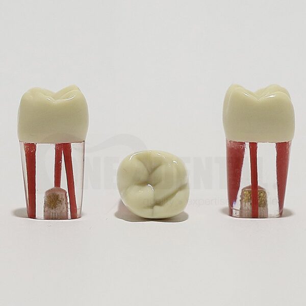 Endo Tooth 16 (3 Canals) for ADC Model(مدل دندان Endo 16 (۳ کانال) برای مدل ADC)