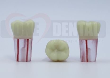 Endo Tooth 46 (3 canal) for ADC Model (مدل دندان Endo 46 (۳ کانال) برای مدل ADC)